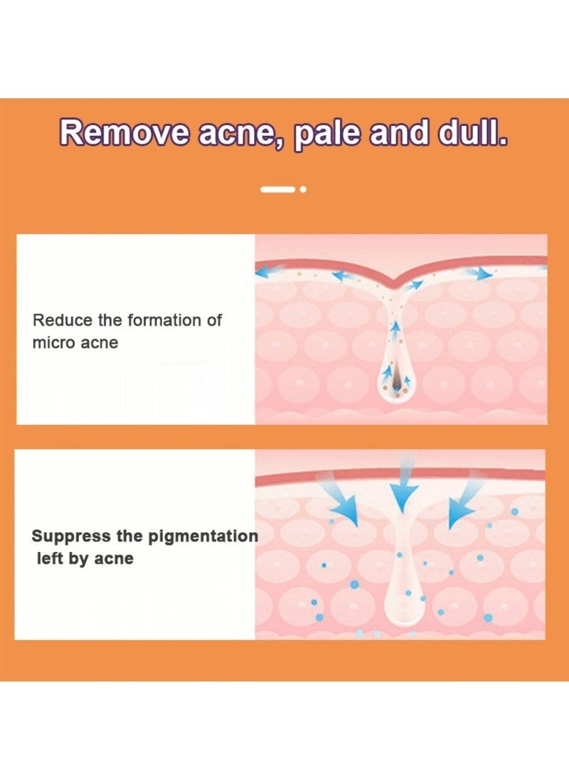 DERMFREE Acne Cream 20g, Soothes Face & Reduces Blackheads, adapalene gel for benzoyl peroxide, Pimples & Blemishes | Oil Control & Redness Relief for Sensitive, Oily & Acne-Prone Skin - Image 2